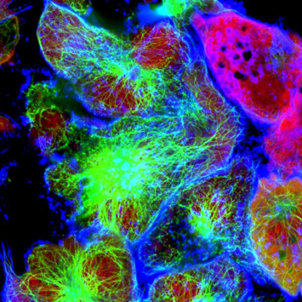 Cancer cells