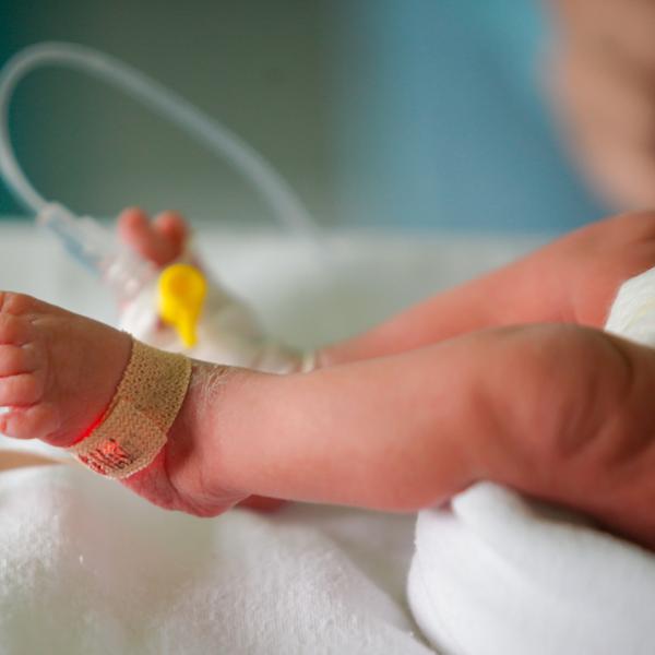 Preterm baby