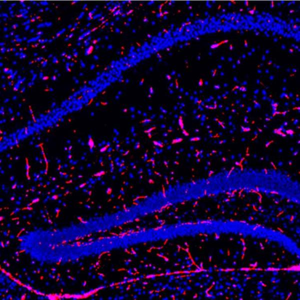 TSPO expression in the hippocampal region of a mouse brain