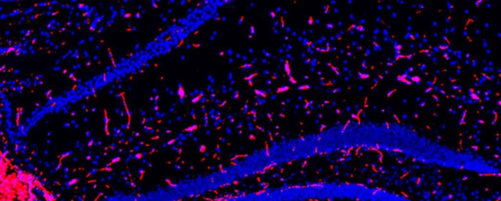 TSPO expression in the hippocampal region of a mouse brain